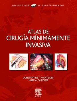 ATLAS DE CIRUGÍA MÍNIMAMENTE INVASIVA + DVD-ROM